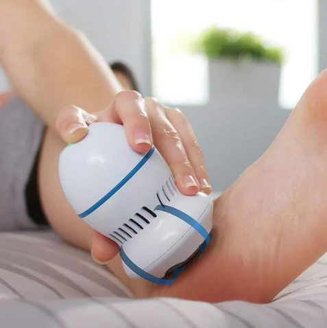 Removedor Elétrico Beauty Feet – Diga Adeus a Calos e Rachaduras - NextWave Store